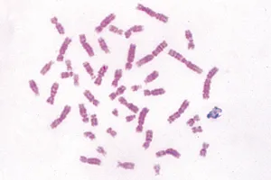 Kromosomer fra menneske, metafase (079180)