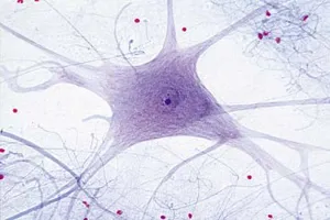 Mikropræparat motoriske nerveceller (079230)