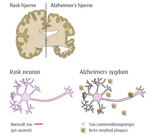 Analyse af Alzheimerrisikofaktorer, Edvotek kit 1115 (7781115)