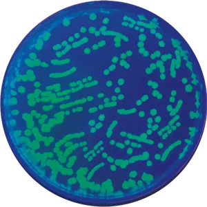 Transformation af E. coli med GFP (778223)
