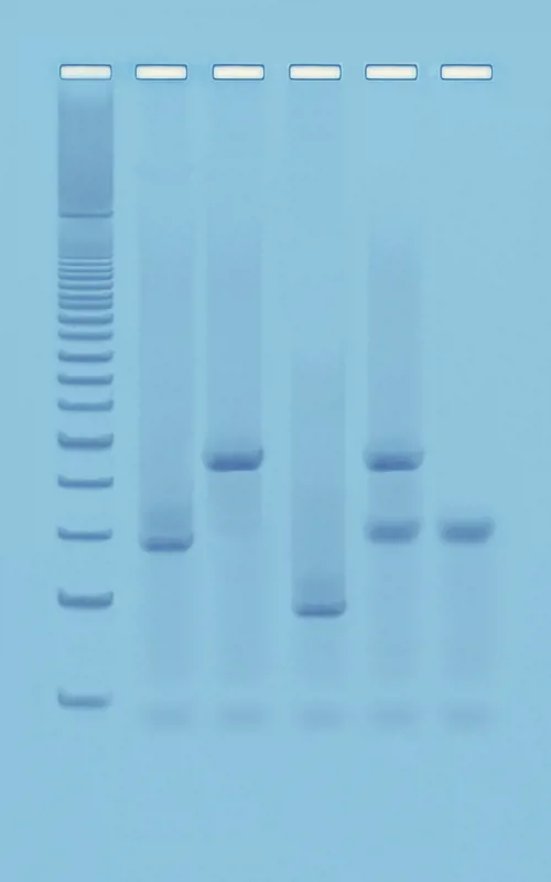 PCR baseret DNA fingerprinting (778371)
