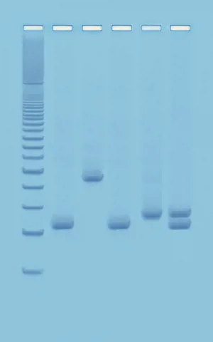 PCR-baseret vandkvalitetsanalyse (778953)