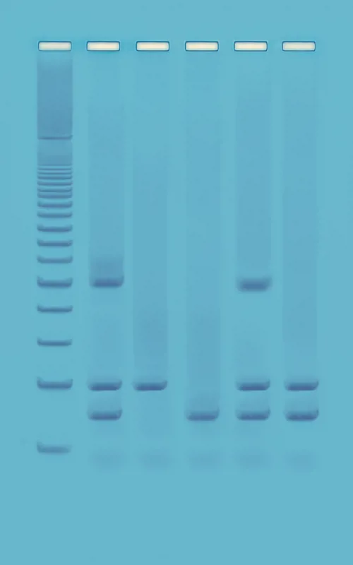 PCR-identifikation GMO-prod. i fødevarer (778962)