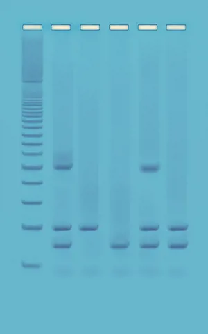 PCR-identifikation GMO-prod. i fødevarer (778962)