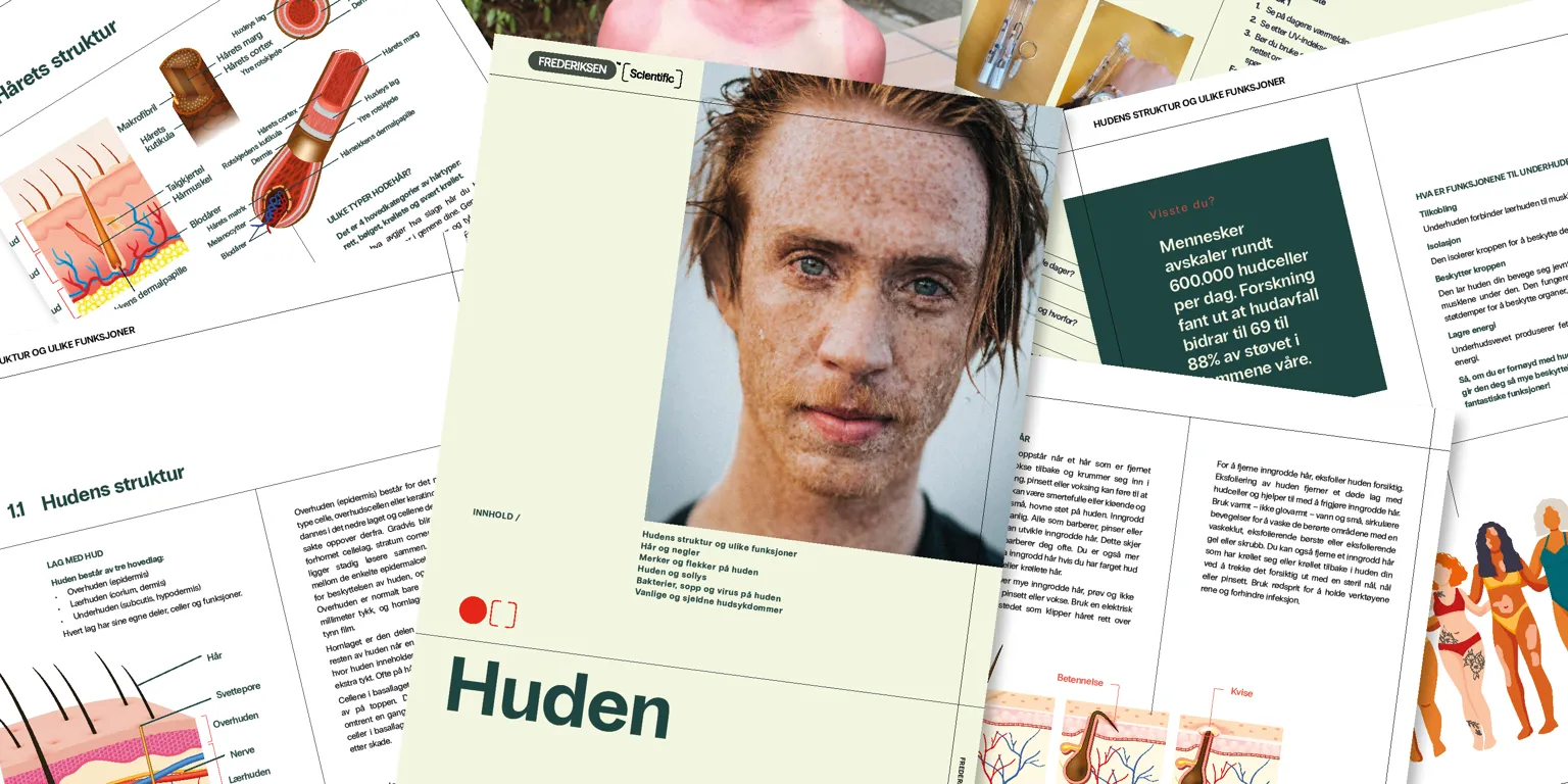 Merker og flekker på huden