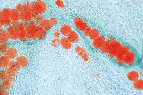 Fedtvæv, menneske, Sudan - præparat  (079173)