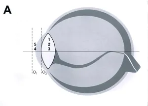 Optiksæt med laser ray box  (294100)