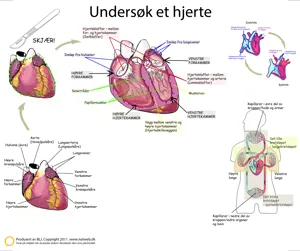 Disseksjonsduk hjertet, 60 x 75 cm  (671111)