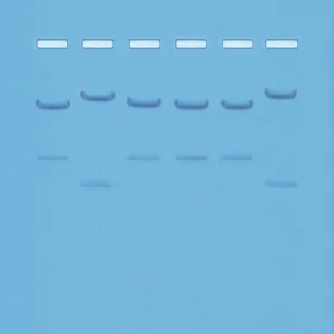 DNA-fingerprinting I  (778109)