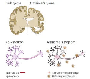 Analyse af Alzheimerrisikofaktorer, Edvotek kit 1115  (7781115)