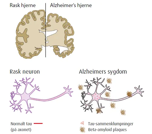 Analyse af Alzheimerrisikofaktorer, Edvotek kit 1115  (7781115)