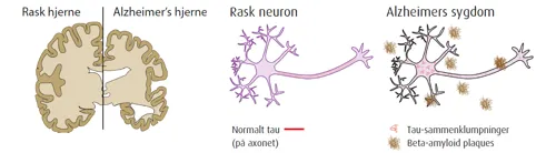 Analyse af Alzheimerrisikofaktorer, Edvotek kit 1115  (7781115)