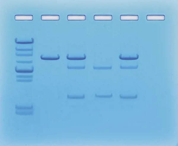 På jagt efter kræftgenet I På jagt efter kræftgenet I (778115)