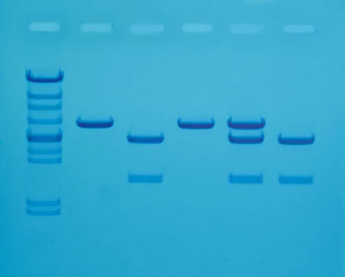 Kolesterol diagnostik Edvotek  (778118)