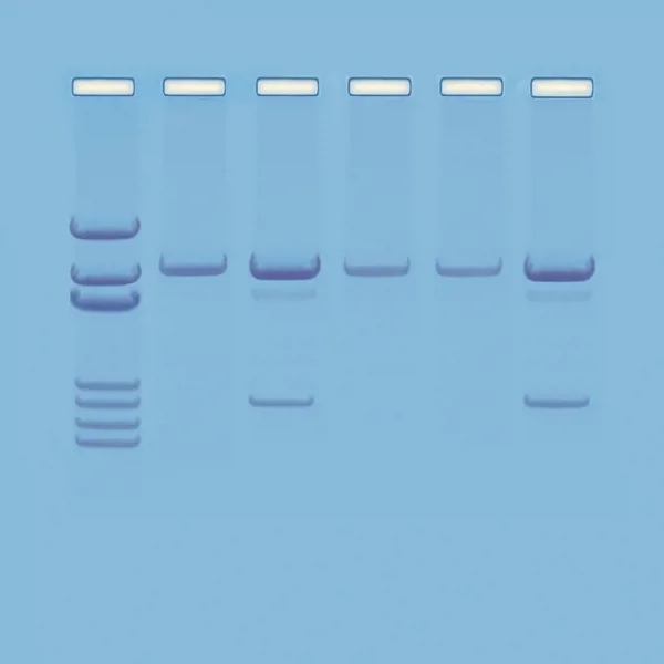 Undersøgelse af GMO, ready-to-load  (778121)