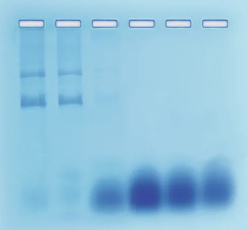 Adskillelse DNA-RNA søjlechromatografi  (778204)