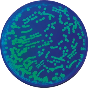 Transformation af E. coli med GFP  (778223)