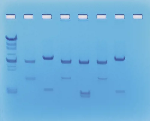 DNA-fingerprinting II  (778225)