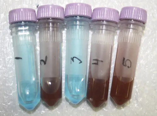 Diabetestest ELISA + urin-glucose  (778280)