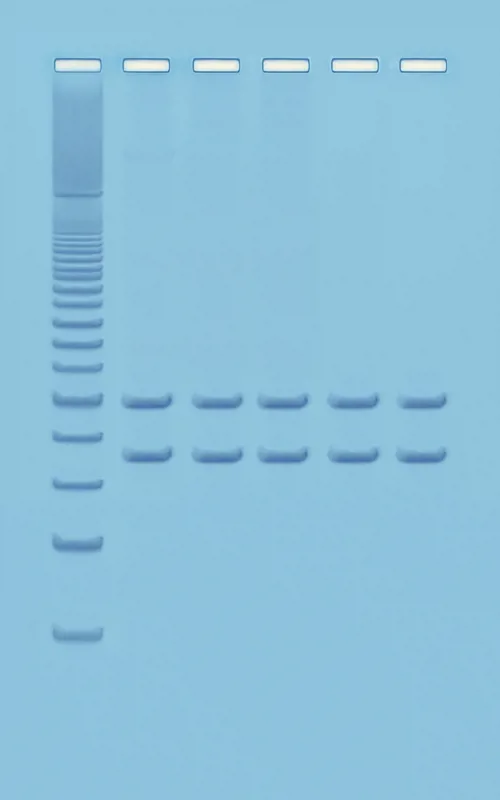 PCR-analyse af eget mitochondrie DNA  (778332)