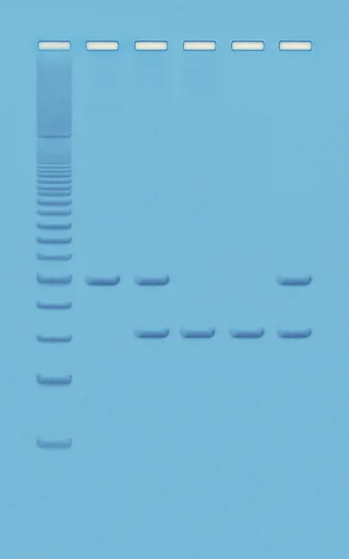 PCR baseret DNA-analyse-Humant DNA  (778333)