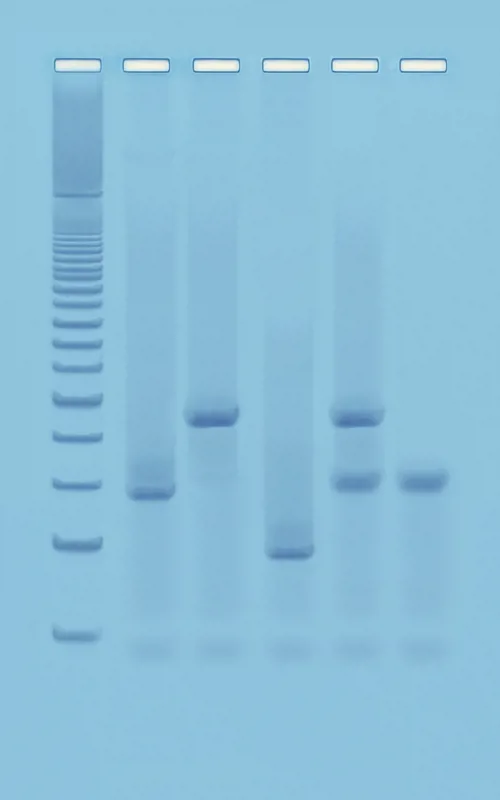 PCR baseret DNA fingerprinting  (778371)