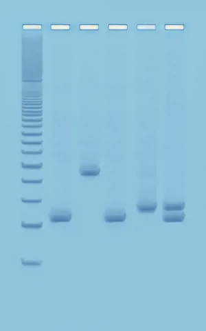 PCR-baseret vandkvalitetsanalyse  (778953)