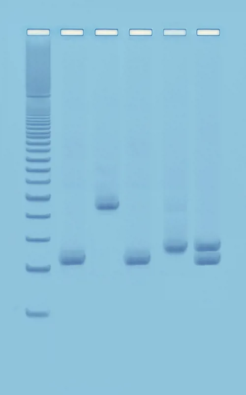 PCR-baseret vandkvalitetsanalyse  (778953)