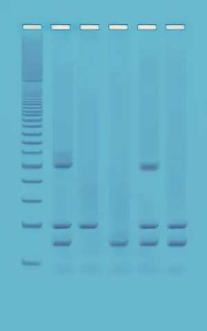 PCR-identifikation GMO-prod. i fødevarer  (778962)