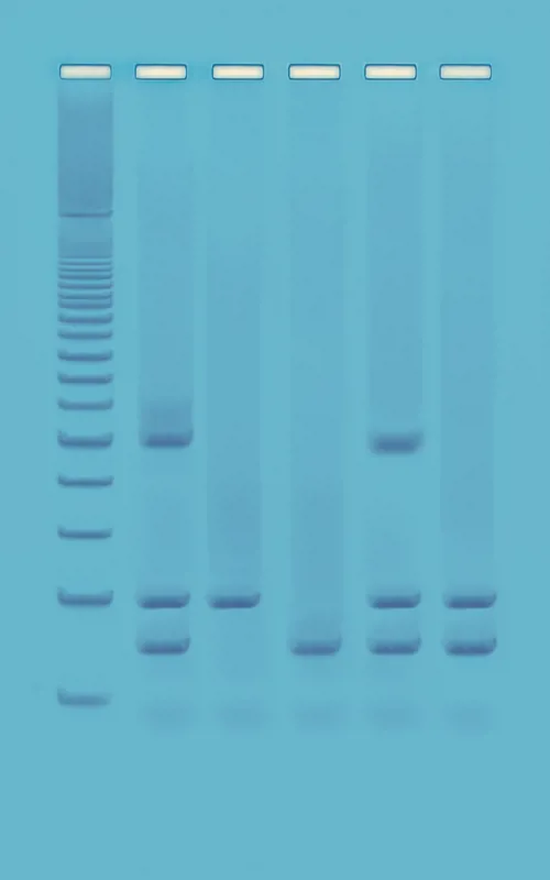 PCR-identifikation GMO-prod. i fødevarer  (778962)