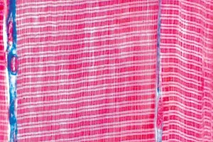 Voorbereiding. Gestreepte spieren Voorbereiding. Gestreepte spieren (NL210136)