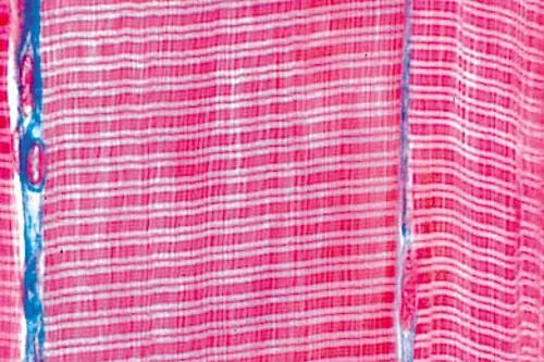 Voorbereiding. Gestreepte spieren Voorbereiding. Gestreepte spieren (NL210136)