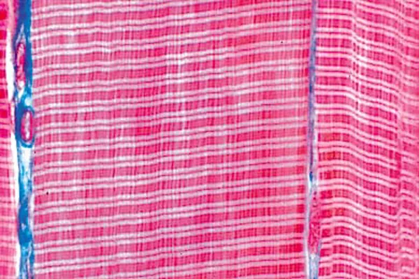 Forberedelse. Stripete muskler Forberedelse. Stripete muskler (NL210136)