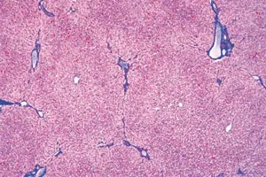 Præp. lever menneske, dds  (NL210347)