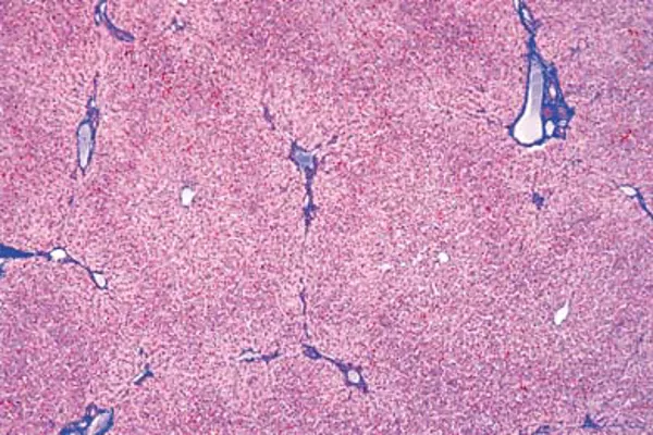 Præp. lever menneske, dds  (NL210347)