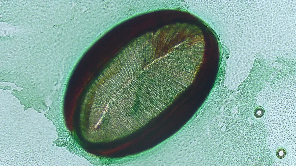 Preparaat ademopening (stigma) insect
